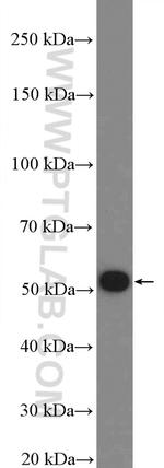 FBXO31 Antibody in Western Blot (WB)