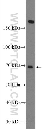 FBXO31 Antibody in Western Blot (WB)