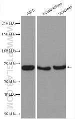 GBP2 Antibody in Western Blot (WB)