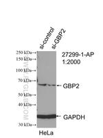 GBP2 Antibody in Western Blot (WB)