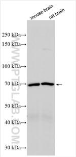 VAChT Antibody in Western Blot (WB)