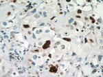 KI67 Antibody in Immunohistochemistry (Paraffin) (IHC (P))