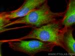 SERCA2, ATP2A2 Antibody in Immunocytochemistry (ICC/IF)