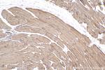SERCA2, ATP2A2 Antibody in Immunohistochemistry (Paraffin) (IHC (P))