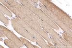 SERCA2, ATP2A2 Antibody in Immunohistochemistry (Paraffin) (IHC (P))