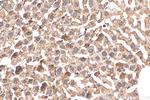 SERCA2, ATP2A2 Antibody in Immunohistochemistry (Paraffin) (IHC (P))