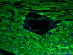 SERCA2, ATP2A2 Antibody in Immunohistochemistry (PFA fixed) (IHC (PFA))