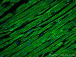 SERCA2, ATP2A2 Antibody in Immunohistochemistry (PFA fixed) (IHC (PFA))