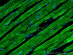 SERCA2, ATP2A2 Antibody in Immunohistochemistry (PFA fixed) (IHC (PFA))