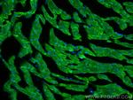 SERCA2, ATP2A2 Antibody in Immunohistochemistry (PFA fixed) (IHC (PFA))