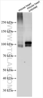 SERCA2, ATP2A2 Antibody in Western Blot (WB)