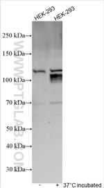 SERCA2, ATP2A2 Antibody in Western Blot (WB)