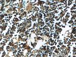 AAGAB Antibody in Immunohistochemistry (Paraffin) (IHC (P))