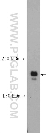 CEP170 Antibody in Western Blot (WB)