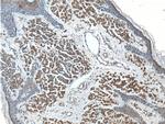 SILV Antibody in Immunohistochemistry (Paraffin) (IHC (P))