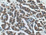 SILV Antibody in Immunohistochemistry (Paraffin) (IHC (P))