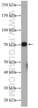SILV Antibody in Western Blot (WB)