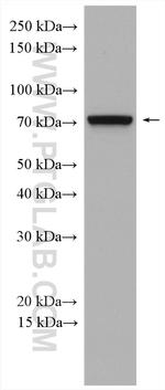 IFT74 Antibody in Western Blot (WB)