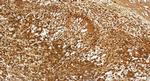 HEATR3 Antibody in Immunohistochemistry (Paraffin) (IHC (P))