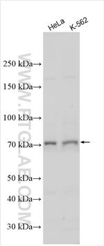HEATR3 Antibody in Western Blot (WB)