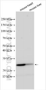 MRPL35 Antibody in Western Blot (WB)