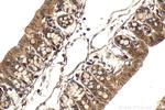 SOCS6 Antibody in Immunohistochemistry (Paraffin) (IHC (P))