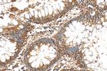 SOCS6 Antibody in Immunohistochemistry (Paraffin) (IHC (P))