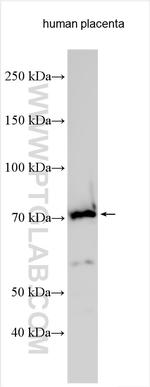 SOCS6 Antibody in Western Blot (WB)