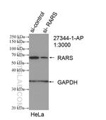 RARS Antibody in Western Blot (WB)