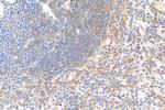 IL-1R1 Antibody in Immunohistochemistry (Paraffin) (IHC (P))