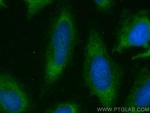Follistatin Antibody in Immunocytochemistry (ICC/IF)