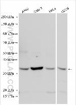Follistatin Antibody in Western Blot (WB)