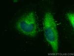 ULK1 Antibody in Immunocytochemistry (ICC/IF)