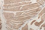 ULK1 Antibody in Immunohistochemistry (Paraffin) (IHC (P))