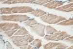 ULK1 Antibody in Immunohistochemistry (Paraffin) (IHC (P))