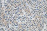 ULK1 Antibody in Immunohistochemistry (Paraffin) (IHC (P))