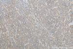 ULK1 Antibody in Immunohistochemistry (Paraffin) (IHC (P))