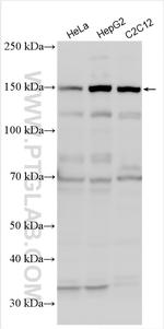 ULK1 Antibody in Western Blot (WB)