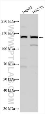 ULK1 Antibody in Western Blot (WB)