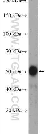 GLTSCR2 Antibody in Western Blot (WB)