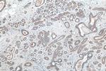 TACSTD2/TROP2 Antibody in Immunohistochemistry (Paraffin) (IHC (P))
