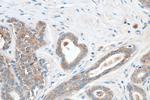 TACSTD2/TROP2 Antibody in Immunohistochemistry (Paraffin) (IHC (P))