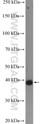 CYSLTR1 Antibody in Western Blot (WB)