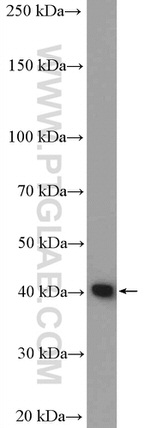 CYSLTR1 Antibody in Western Blot (WB)