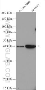 CYSLTR1 Antibody in Western Blot (WB)