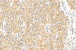 C19orf12 Antibody in Immunohistochemistry (Paraffin) (IHC (P))