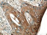 ABI1 Antibody in Immunohistochemistry (Paraffin) (IHC (P))