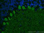 RGS8 Antibody in Immunohistochemistry (PFA fixed) (IHC (PFA))