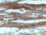 PRKACA Antibody in Immunohistochemistry (Paraffin) (IHC (P))