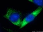 RAB5B Antibody in Immunocytochemistry (ICC/IF)
